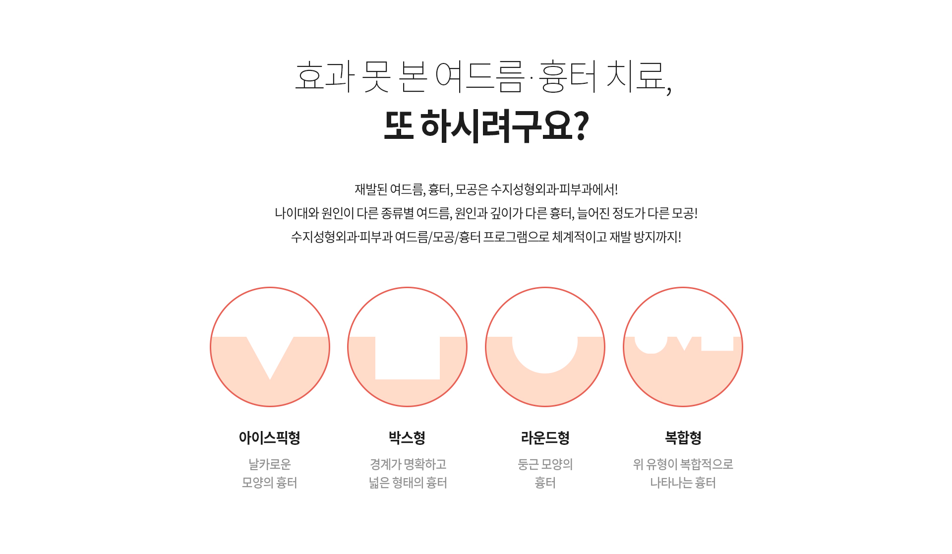 효과 못 본 여드름, 흉터 치료, 또 하시려구요? 재발된 여드름, 흉터, 모공은 수지의원에서! 나이대와 원인이 다른 종류별 여드름, 원인과 깊이가 다른 흉터, 늘어진 정도가 다른 모공! 수지의원 여드름/모공/흉터 프로그램으로 체계적이고 재발 방지까지! 흉터 모양에 따른 맞춤 레이저 치료 아이스픽형 날카로운 모양의 흉터 박스형 경계가 명확하고 넓은 형태의 흉터 라운드형 둥근 모양의 흉터 복합형 위 유형이 복합적으로 나타나는 흉터