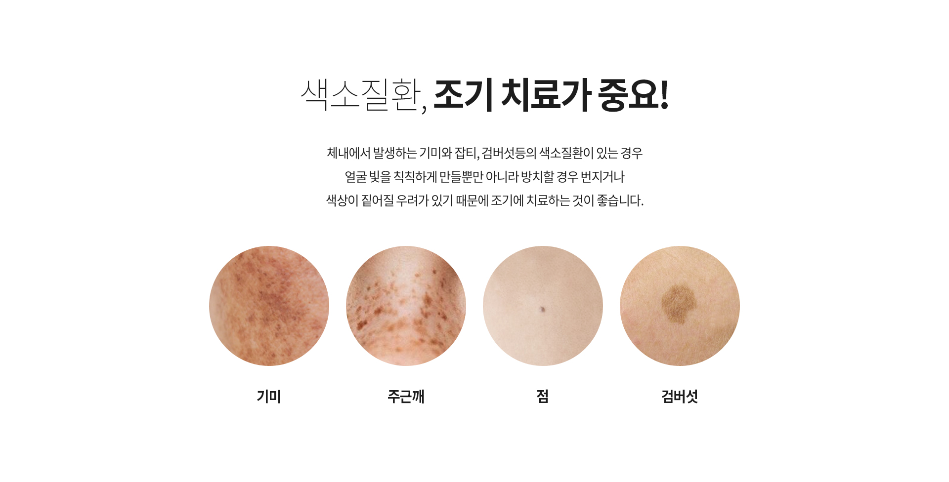 색소질환, 조기 치료가 중요! 체내에서 발생하는 기미와 잡티, 검버섯등의 색소질환이 있는 경우 얼굴 빛을 칙칙하게 만들뿐만 아니라 방치할 경우 번지거나 색상이 짙어질 우려가 있기 때문에 조기에 치료하는 것이 좋습니다. 기미/주근깨/점/검버섯
