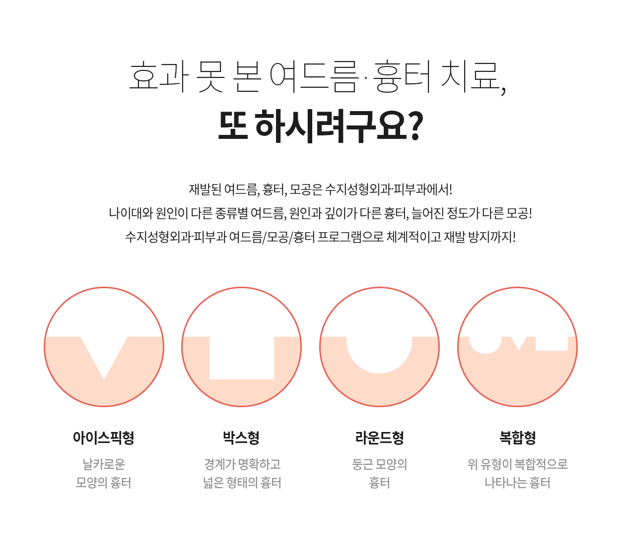 효과 못 본 여드름, 흉터 치료, 또 하시려구요? 재발된 여드름, 흉터, 모공은 수지의원에서! 나이대와 원인이 다른 종류별 여드름, 원인과 깊이가 다른 흉터, 늘어진 정도가 다른 모공! 수지의원 여드름/모공/흉터 프로그램으로 체계적이고 재발 방지까지! 흉터 모양에 따른 맞춤 레이저 치료 아이스픽형 날카로운 모양의 흉터 박스형 경계가 명확하고 넓은 형태의 흉터 라운드형 둥근 모양의 흉터 복합형 위 유형이 복합적으로 나타나는 흉터