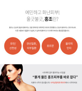 예민하고 화난피부! 울긋불긋, 홍조란? 홍조는 단순히 얼굴이 붉어지는 것을 뜻하지만 의학적인 의미의 안면홍조는 단순히 붉어지는 것이 아니라 다른 사람보다 얼굴이 더 쉽게, 더 심하게 붉어지고 더 오래 지속되는 증상을 말합니다. 유전/선천성/전신질환,피부질환/호르몬/물리적인자 시도때도 없이 빨개지는 내 얼굴 “붉게 물든 홍조피부를 바로 잡다” 치료의 시작이 중요합니다! 수지성형외과 피부과에서 시작하세요